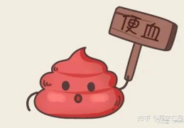 4个最为明显的肠癌信号,揭秘四大关键信号”