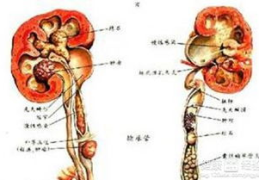 肾结核怎么治疗,肾结核治疗策略与方案详解